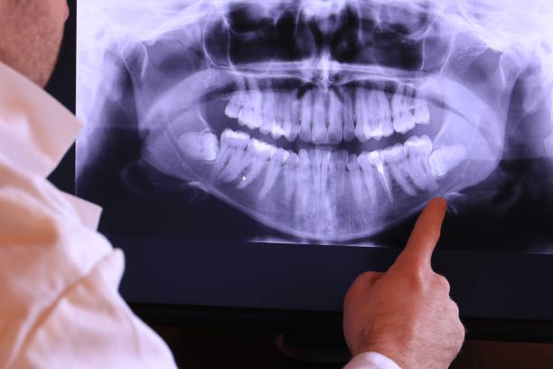 Best Emergency Root Canal Treatment in Demarest, NJ