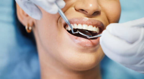 Best Emergency Tooth Extraction in Demarest, NJ