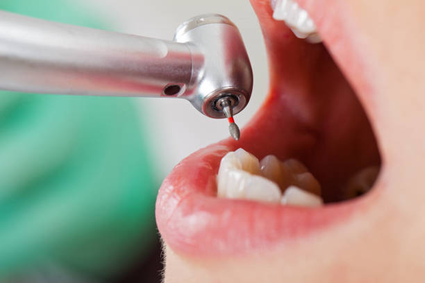 Best Emergency Treatment for Toothache in Demarest, NJ
